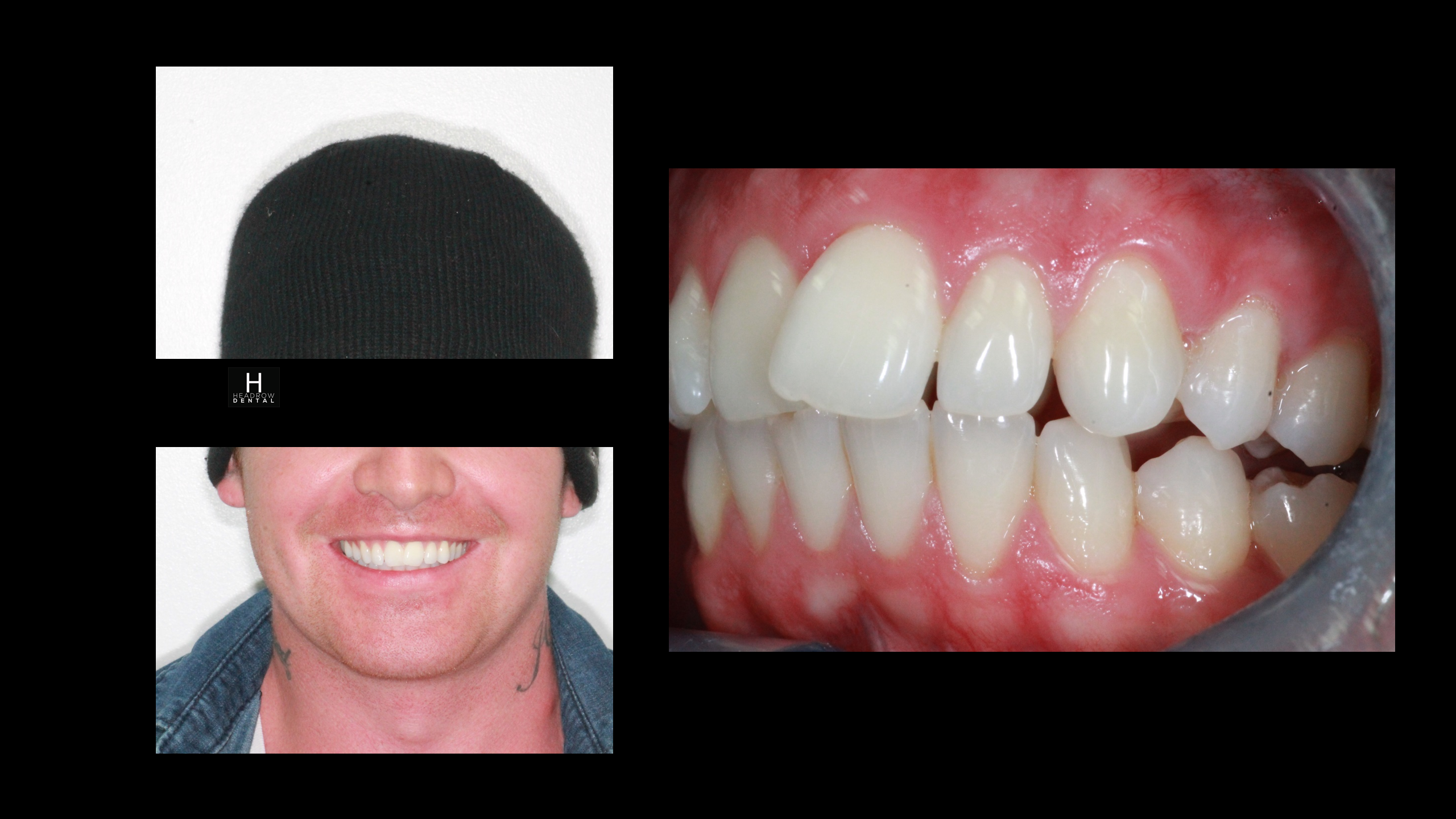 Orthodontics 2 a