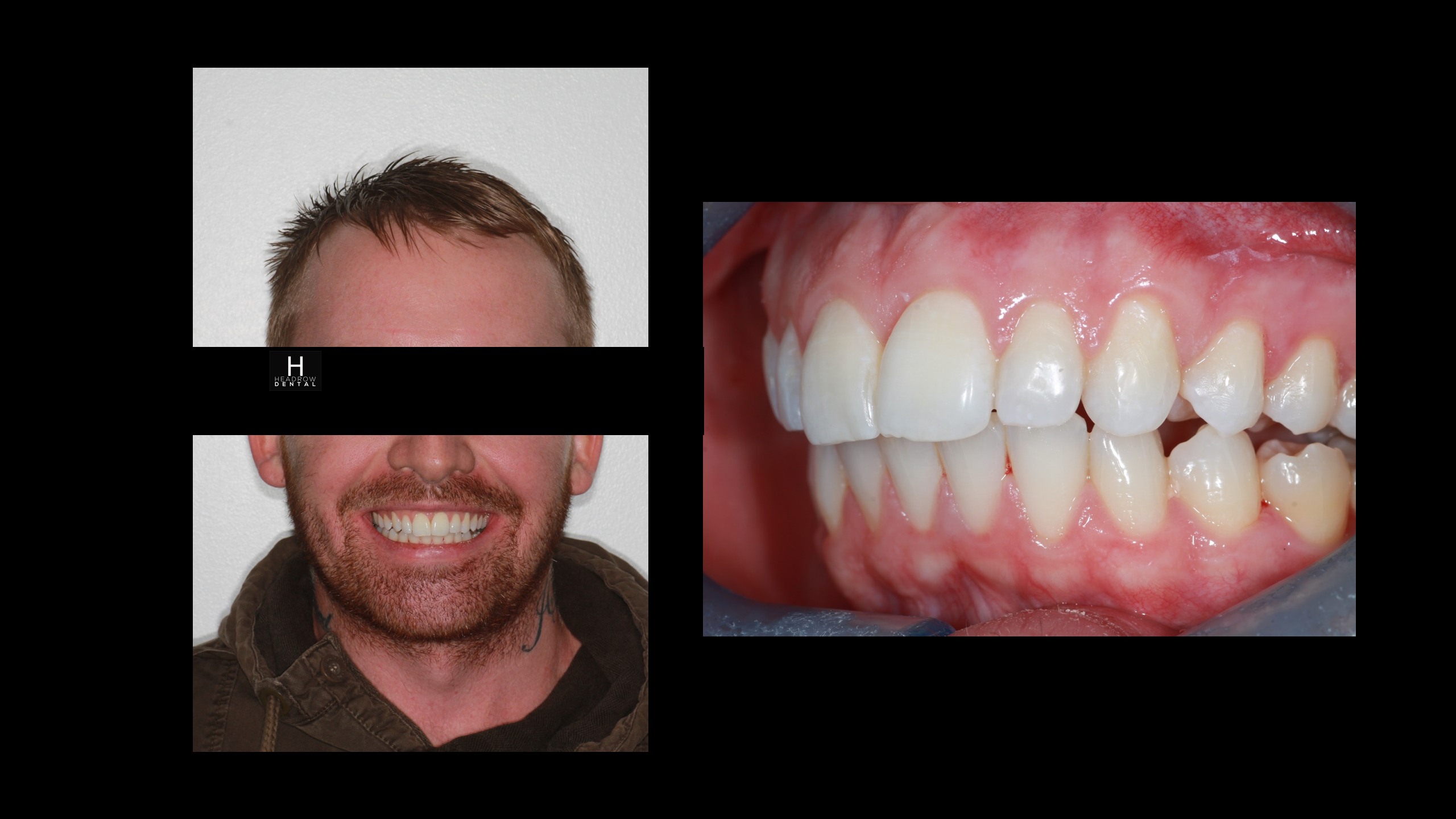 Orthodontics 2 b